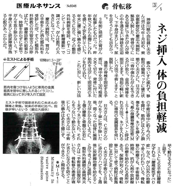 読売新聞2015年4月22日掲載記事